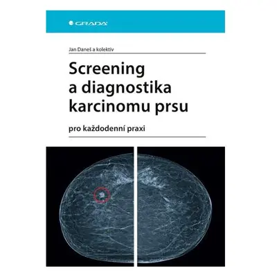 Screening a diagnostika karcinomu prsu pro každodenní praxi