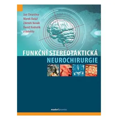 Funkční stereotaktická neurochirurgie