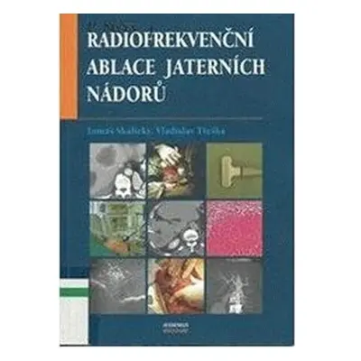 Radiofrekvenční ablace jaterních nádorů