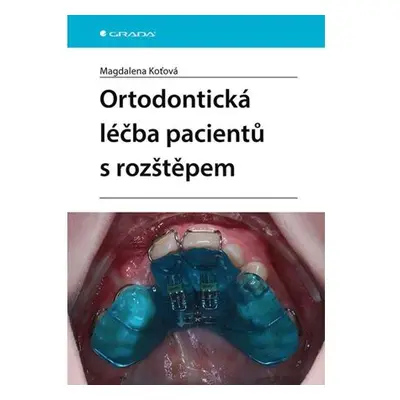 Ortodontická léčba pacientů s rozštěpem