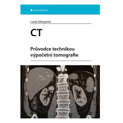 CT - Průvodce technikou výpočetní tomografie