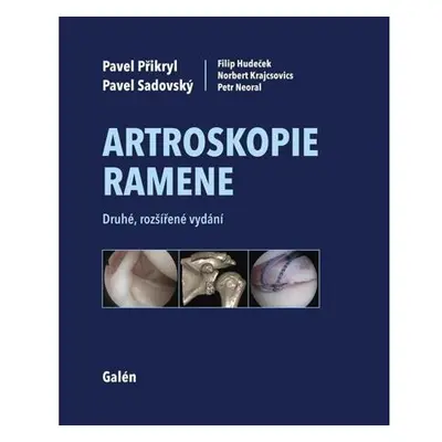 Artroskopie ramene