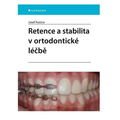 Retence a stabilita v ortodontické léčbě