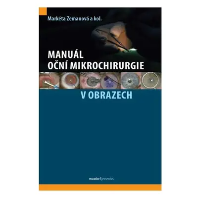 Manuál oční mikrochirurgie v obrazech