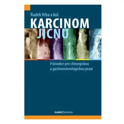 Karcinom jícnu - Průvodce pro chirurgickou a gastroenterologickou praxi