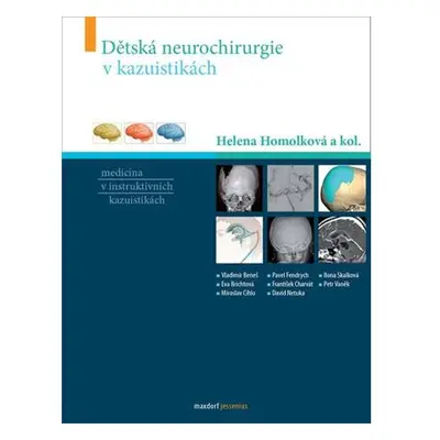 Dětská neurochirurgie v kazuistikách