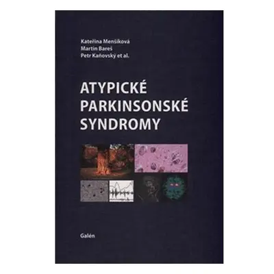 Atypické parkinsonské syndromy