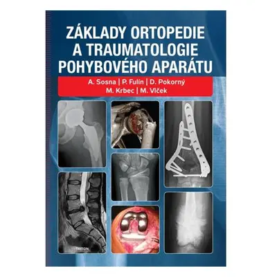 Základy ortopedie a traumatologie pohybového aparátu