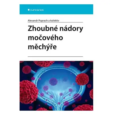 Zhoubné nádory močového měchýře