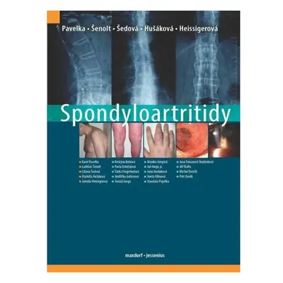 Spondyloartritidy