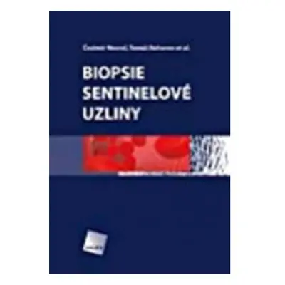 Biopsie sentinelové uzliny