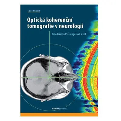 Optická koherenční tomografie v neurologii