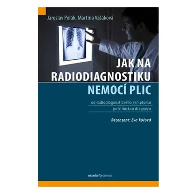 Jak na radiodiagnostiku nemocí plic