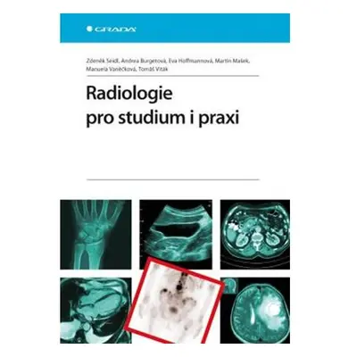 Radiologie pro studium i praxi