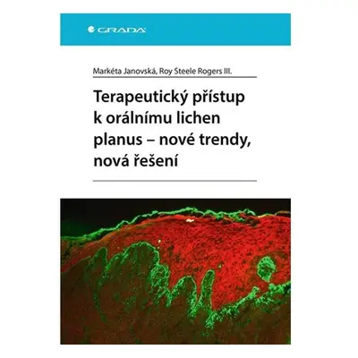 Terapeutický přístup k orálnímu lichen planus - nové trendy, nová řešení