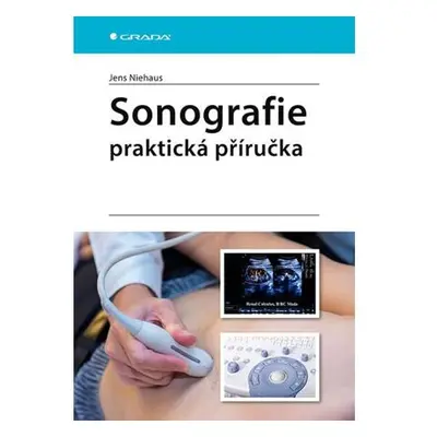 Sonografie - praktická příručka