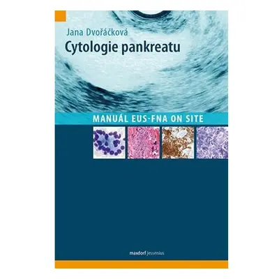 Cytologie pankreatu - Manuál EUS-FNA on site