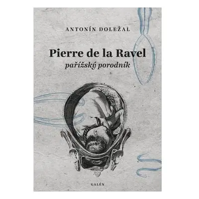 Pierre de la Ravel, pařížský porodník