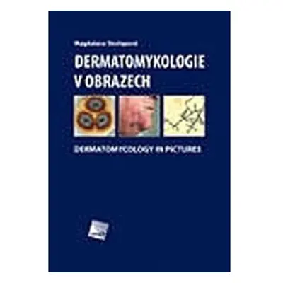 Dermatomykologie v obrazech - Dermatomycology in Pictures