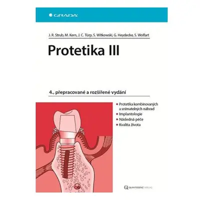 Protetika III