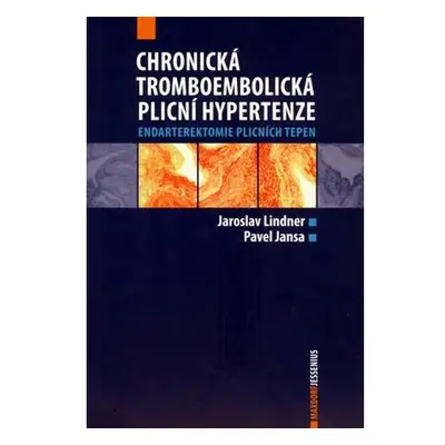 Chronická tromboembolická plicní hypertenze - Endarterektomie plicních tepen