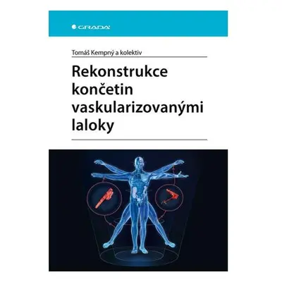 Rekonstrukce končetin vaskularizovanými laloky