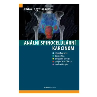 Anální spinocelulární karcinom