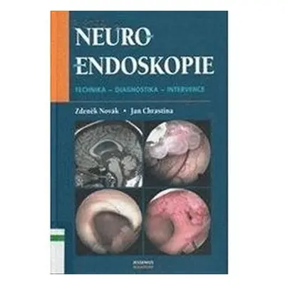 Neuroendoskopie