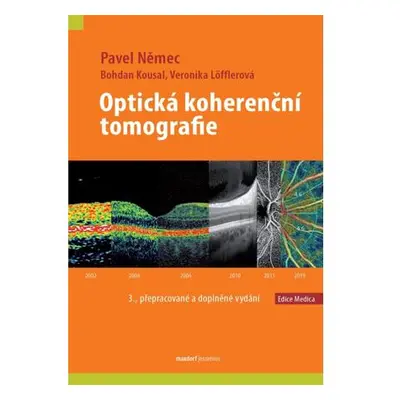 Optická koherenční tomografie