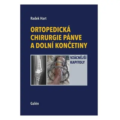 Ortopedická chirurgie pánve a dolní končetiny - Vzácnější kapitoly