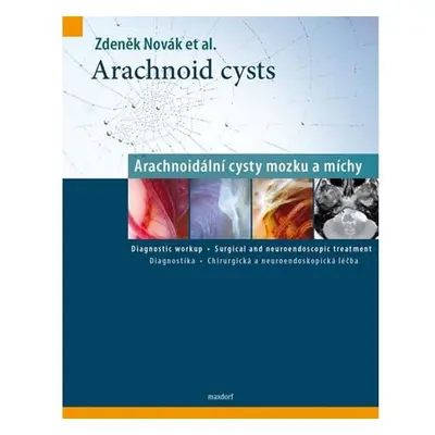 Arachnoid cysts - Arachnoidální cysty mozku a míchy