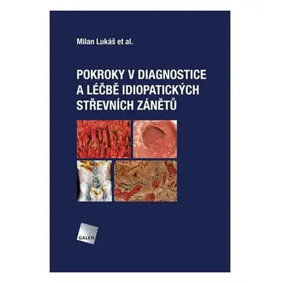 Pokroky v diagnostice a léčbě idiopatických střevních zánětů