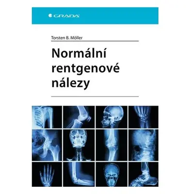 Normální rentgenové nálezy