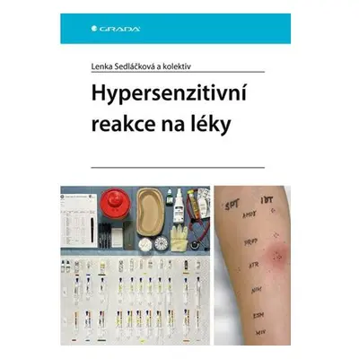 Hypersenzitivní reakce na léky