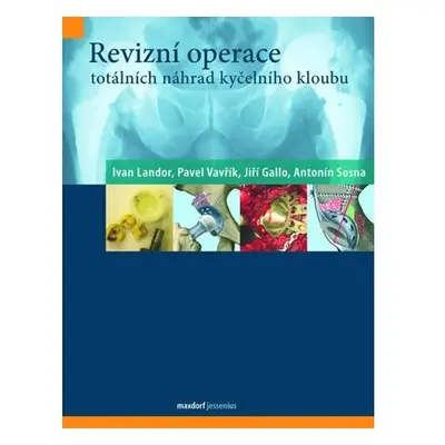 Revizní operace totálních náhrad kyčelního kloubu