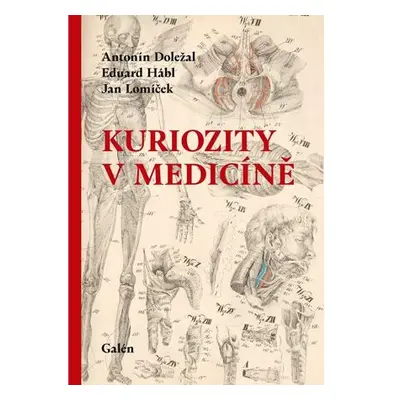 Kuriozity v medicíně