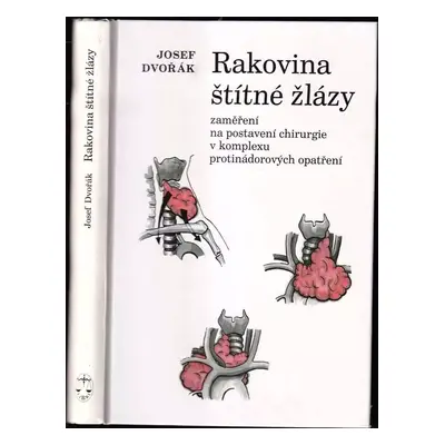 Rakovina štítné žlázy : zaměření na postavení chirurgie v komplexu protinádorových opatření - Jo