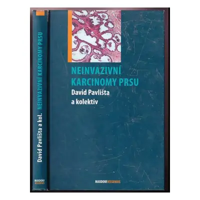 Neinvazivní karcinomy prsu - David Pavlišta (2008, Maxdorf)