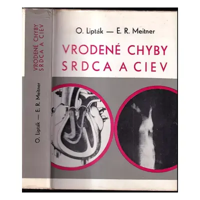 Vrodené chyby srdca a ciev : dérerova zbierka, zv.39 - Ondrej Lipták, E. R Meitner (1973, Osveta