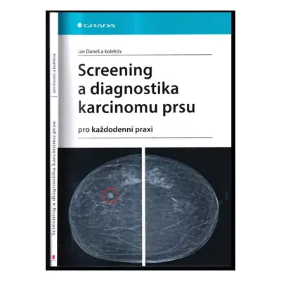 Screening a diagnostika karcinomu prsu : pro každodenní praxi - Jan Daneš (2021, Grada)