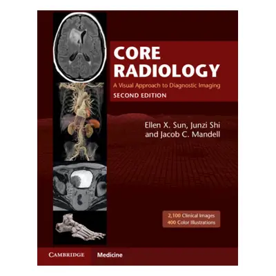 Core Radiology A Visual Approach to Diagnostic Imaging - Multiple copy pack