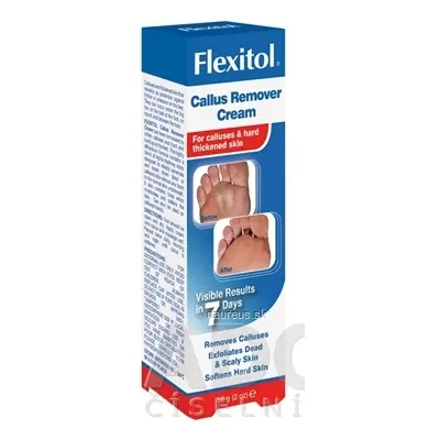 Thornton and Ross Limited FLEXITOL Callus NA otlaků a zhrubnutí KŮŽI 1x56 g 56g