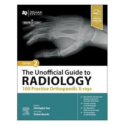 Unofficial Guide to Radiology: 100 Practice Orthopaedic X-rays