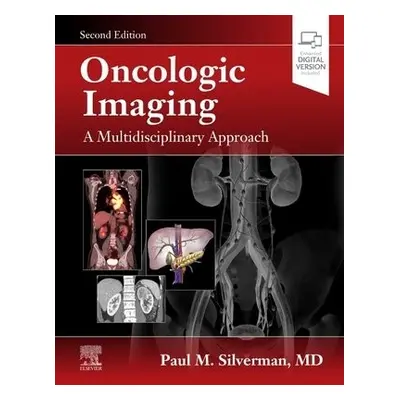 Oncologic Imaging: A Multidisciplinary Approach