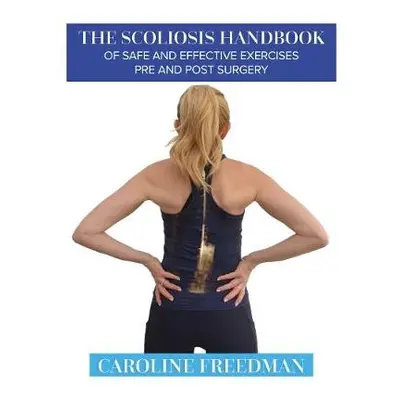 Scoliosis Handbook of Safe and Effective Exercises Pre and Post Surgery - Freedman, Caroline