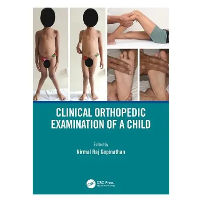 Clinical Orthopedic Examination of a Child