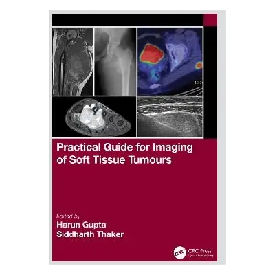 Practical Guide for Imaging of Soft Tissue Tumours