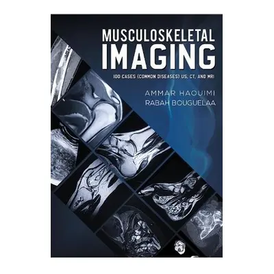 Musculoskeletal Imaging - Haouimi, Ammar a Bouguelaa, Rabah