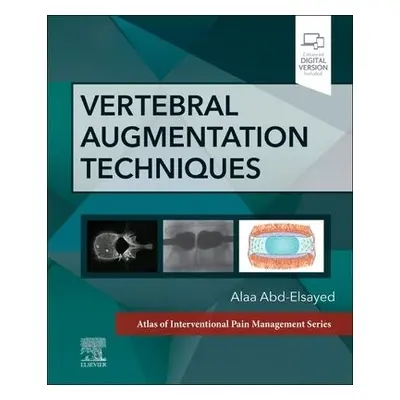 Vertebral Augmentation Techniques