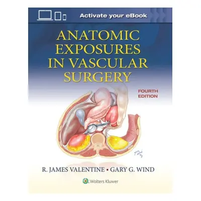 Anatomic Exposures in Vascular Surgery - Valentine, R. James a Wind, Gary G.